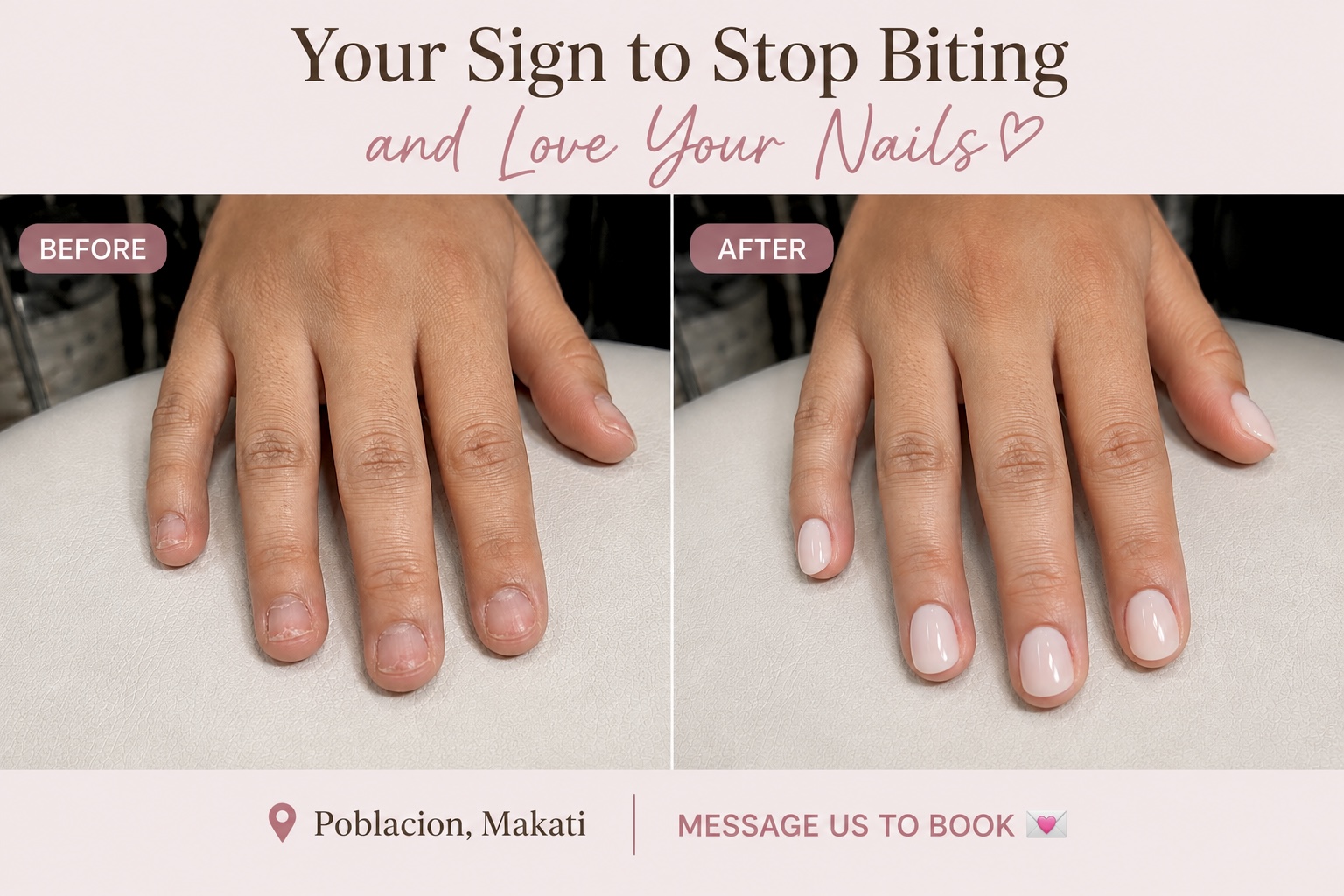 Before and after comparison of a Russian manicure at AyuriNails Beauty Lounge: bitten, ragged cuticles and nail edges before, a smooth rounded cuticle line and glossy nude finish after